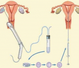 35岁女性备孕请做好以下检查，“健康福州代生宝宝”跑不远